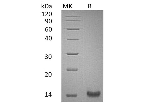 Human Trefoil Factor 1/TFF1 Recombinant Protein (RPES4217)