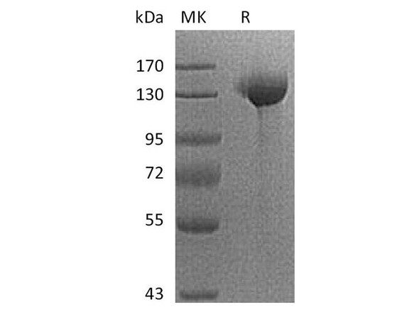Human SIGLEC2/CD22 Recombinant Protein (RPES4218)