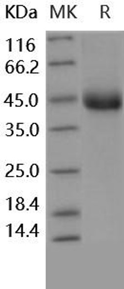 Human TNFRSF1B/CD120b Recombinant Protein (RPES4228)
