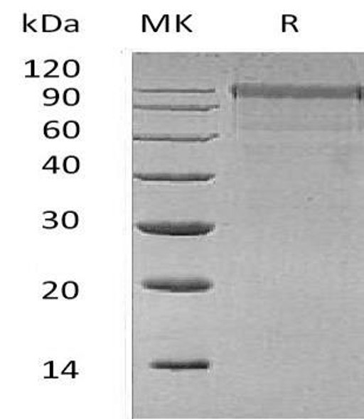 Human MASP1 Recombinant Protein (RPES4231)