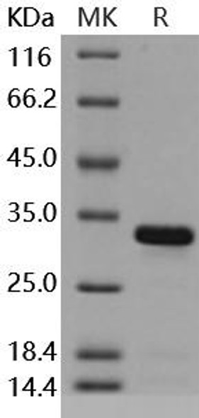 Mouse BCL2L1/Bcl-XL Recombinant Protein (RPES4233)