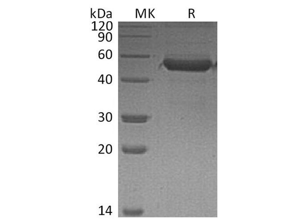 Human MD1 Recombinant Protein (RPES4240)