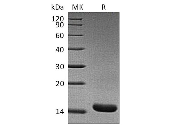 Rat TNF-alpha/TNFA Recombinant Protein (RPES4243)