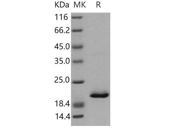 Mouse RBP4 Recombinant Protein (RPES4250)
