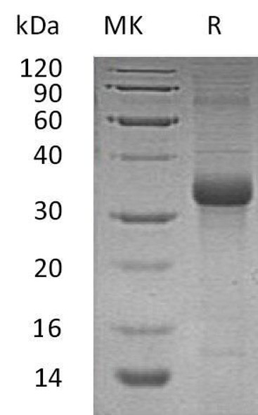 Human FSTL1 Recombinant Protein  (RPES4254)