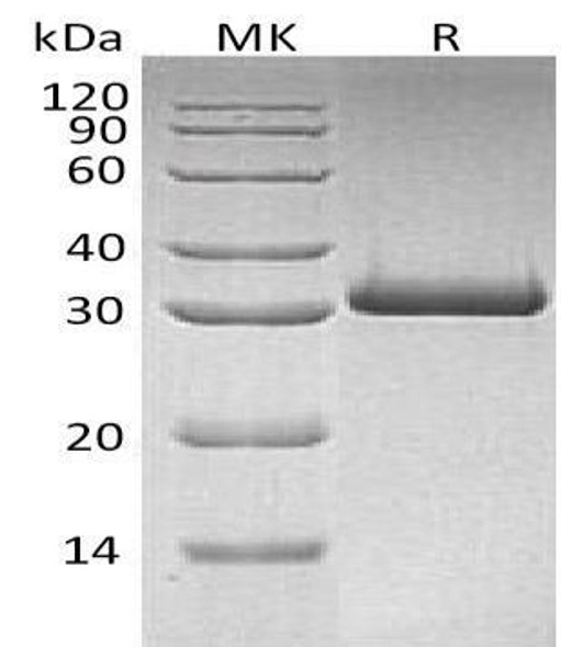 Human MBL2/MBL/COLEC1 Recombinant Protein (RPES4255)
