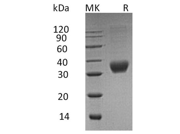 Human Fas/CD95/TNFRSF6 Recombinant Protein (RPES4290)