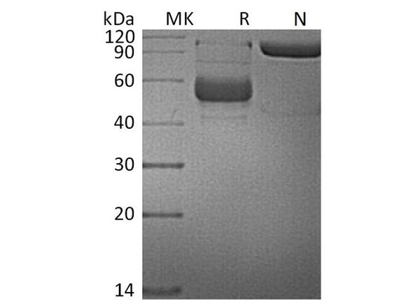 Human TNFSF14/LIGHT Recombinant Protein (RPES4291)
