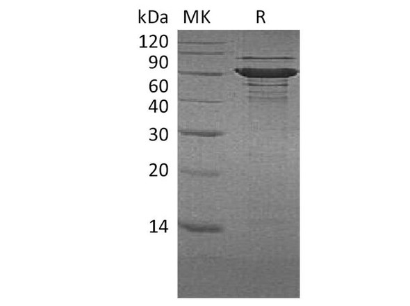 Human BLNK/Ly-57 Recombinant Protein (RPES4292)