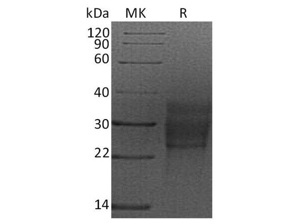 Rat SCF/c-Kit Ligand Recombinant Protein (RPES4293)