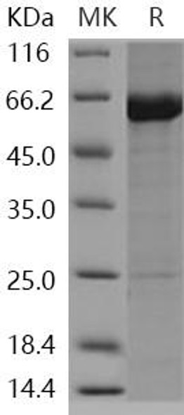 Human KEAP1/INRF2 Recombinant Protein (RPES4295)