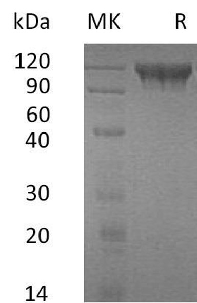 Human Semaphorin 4D/SEMA4D Recombinant Protein (RPES4305)