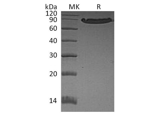 Human E-Cadherin/CDH1 Recombinant Protein (RPES4314)