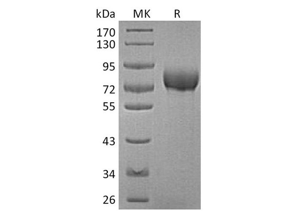 Human BCAM Recombinant Protein (RPES4316)