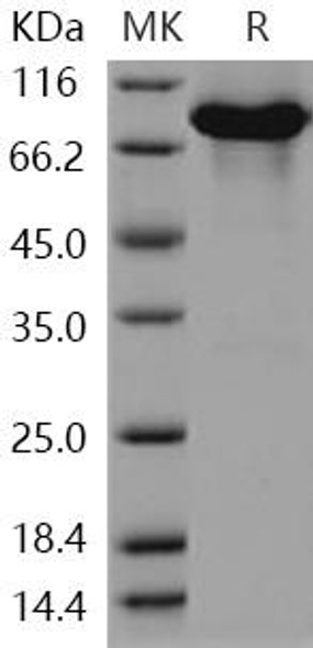 Human KEAP1/INRF2 Recombinant Protein (RPES4319)