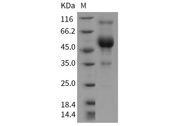 Rat CD83/HB15 Recombinant Protein (RPES4322)