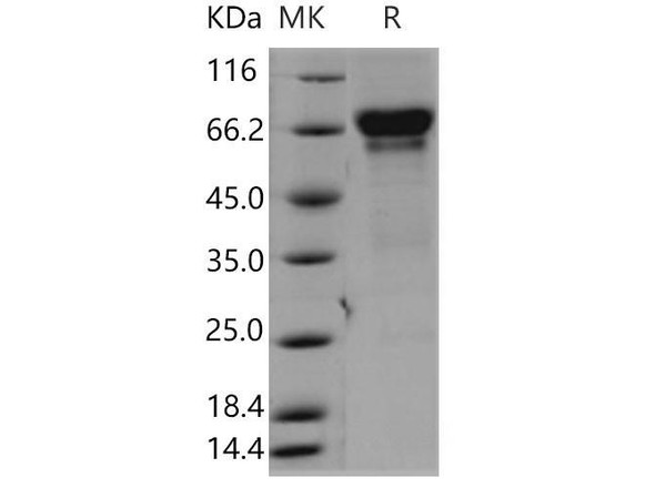 Mouse 4BB/TNFRSF9 Recombinant Protein (RPES4323)