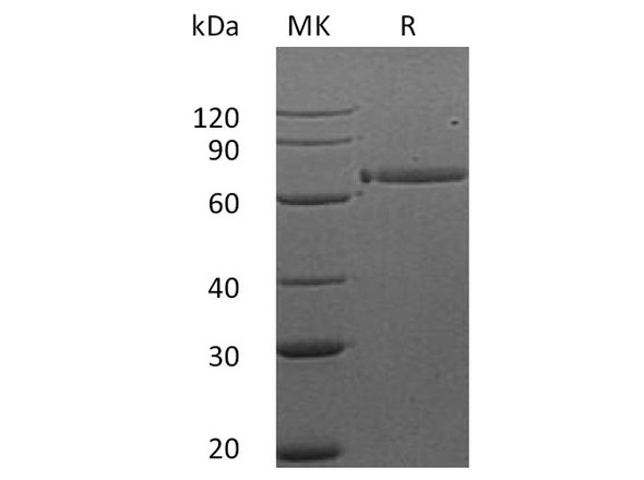 Human HER3/ErbB3 Recombinant Protein (RPES4339)