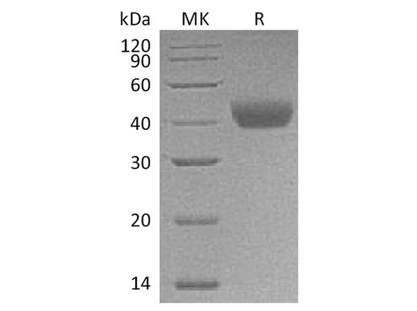 Rat CD38 Recombinant Protein (RPES4342)