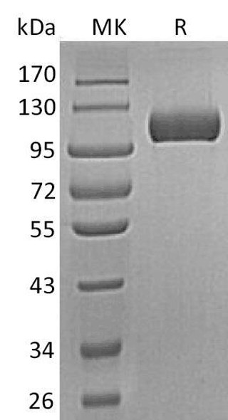 Human Semaphorin 5A/SEMA5A Recombinant Protein (RPES4354)
