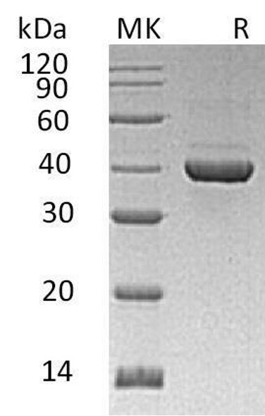 Human ALDOC Recombinant Protein (RPES4376)