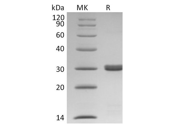 Human BCL2L1/Bcl-XL Recombinant Protein (RPES4389)