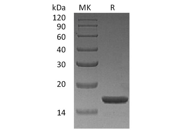 Human ILA/IL Alpha Recombinant Protein (RPES4390)
