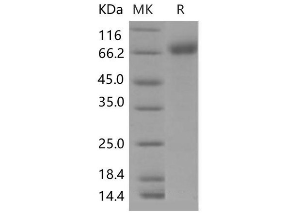 Mouse IL1R1/CD121a Recombinant Protein (RPES4395)