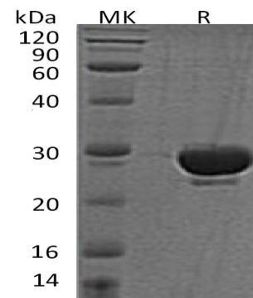 Human SENP2 Recombinant Protein (RPES4402)