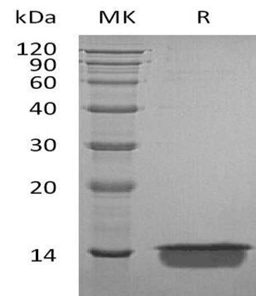 Human MIA Recombinant Protein (RPES4424)