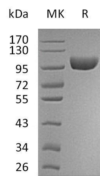 Human VAP/AOC3 Recombinant Protein (RPES4445)