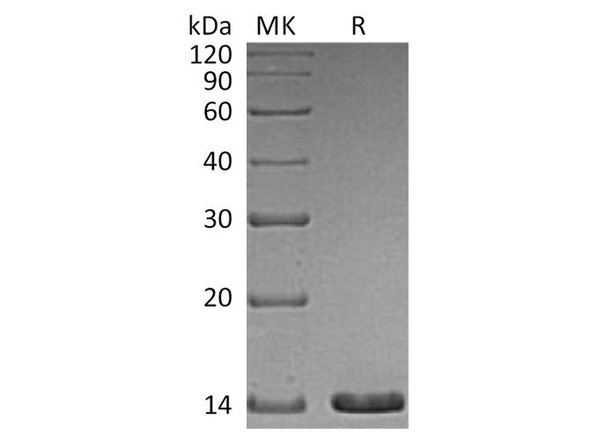 Human Artemin Recombinant Protein (RPES4456)