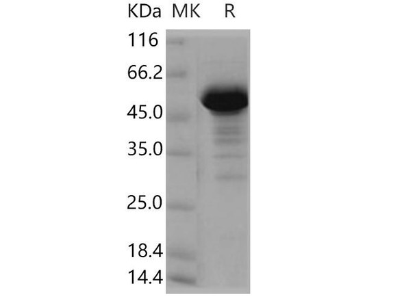 Human NCKIPSD/SPIN90 Recombinant Protein (RPES4478)