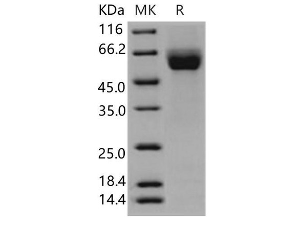Human ROBO4 Recombinant Protein (RPES4479)