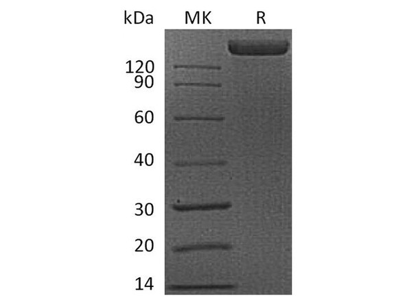 Human FLT1 Recombinant Protein (RPES4497)