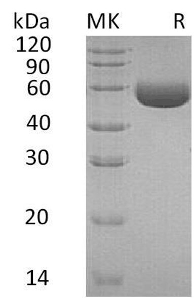 Human Carboxypeptidase M/CPM Recombinant Protein (RPES4508)