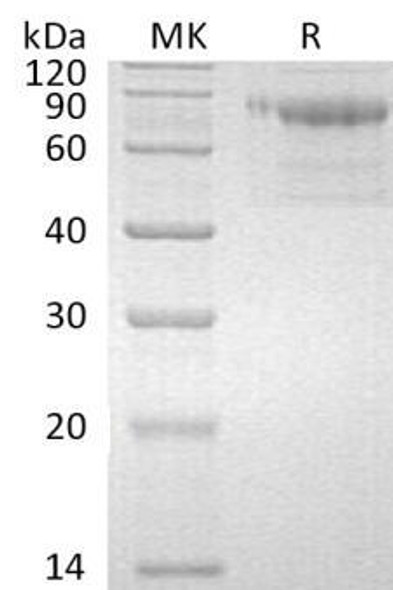 Human SerpinA10/SERPINA10 Recombinant Protein (RPES4511)