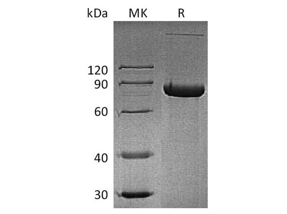 Human CD4/LEU3 Recombinant Protein (RPES4520)