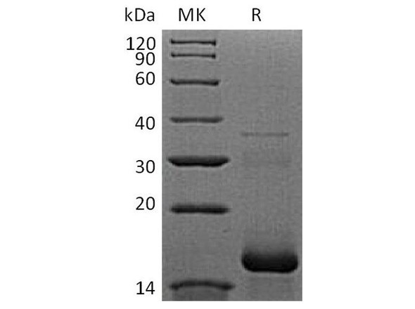 APOB/Apolipoprotein B00 Recombinant Protein (RPES4521)