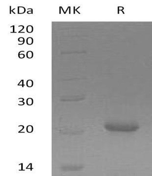 Human GADD45 gamma/GADD45G Recombinant Protein (RPES4530)