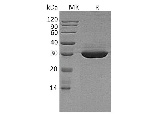 Apolipoprotein A-I/ApoAI Recombinant Protein (RPES4542)