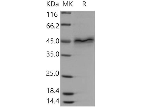 Human Follistatin/FST Recombinant Protein (RPES4569)