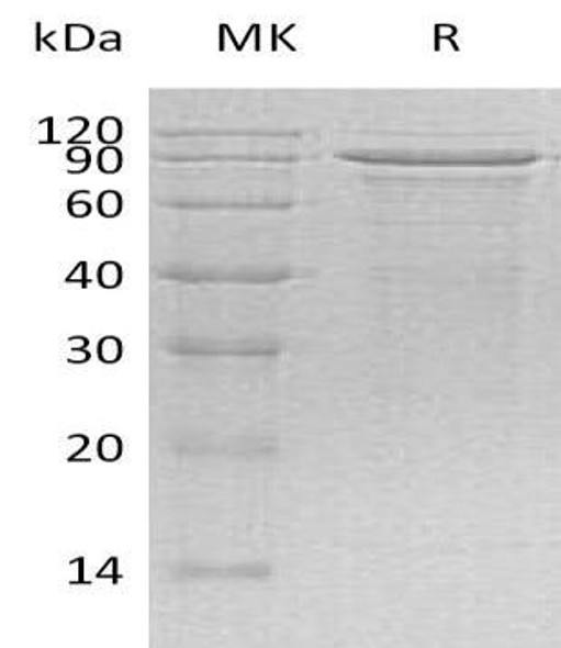 Human MECP2 Recombinant Protein (RPES4573)
