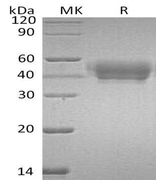 Human SerpinA5/SERPINA5 Recombinant Protein (RPES4574)