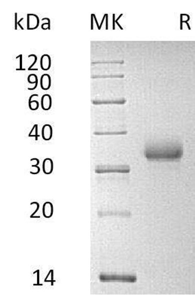 Human CD2 Recombinant Protein (RPES4586)