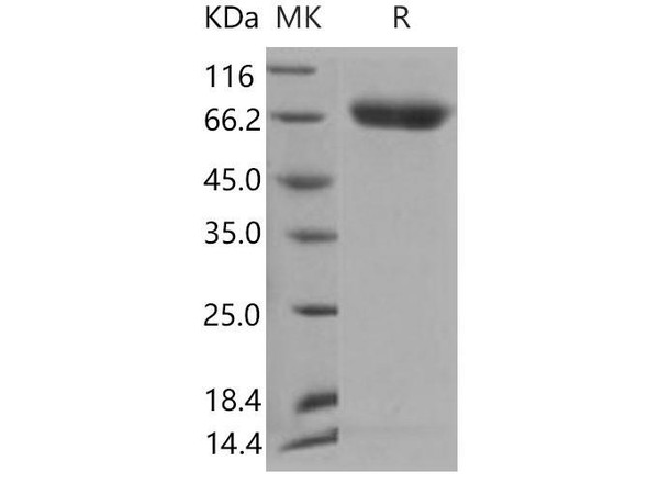 Mouse SerpinD1/HCF2 Recombinant Protein (RPES4589)