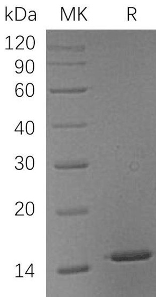 Human Galectin/LGALS1 Recombinant Protein (RPES4593)