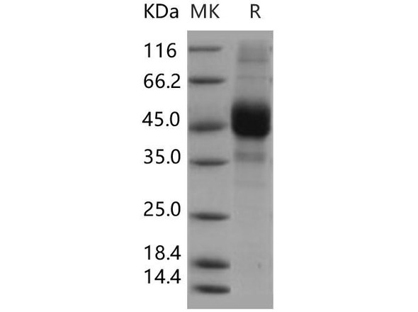 Human CD3d/CD3 delta Recombinant Protein (RPES4605)