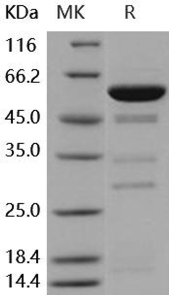 Human Galectin-8/LGALS8 Recombinant Protein (RPES4606)