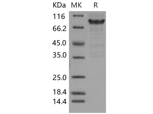 Mouse PSGL/CD162 Recombinant Protein (RPES4608)
